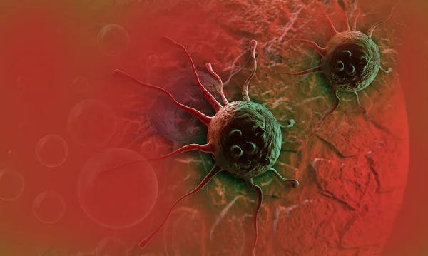 Καρκινικό κύτταρο — Φωτογραφία Αρχείου
