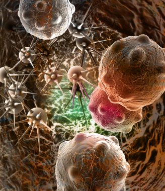 Kanser Hücresi