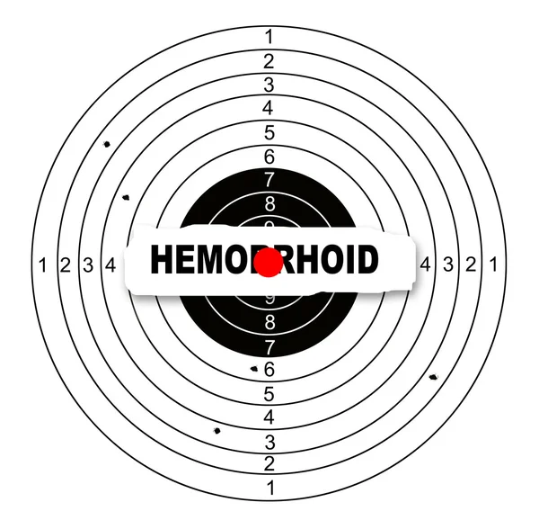 Hemmorhoid — Stok fotoğraf