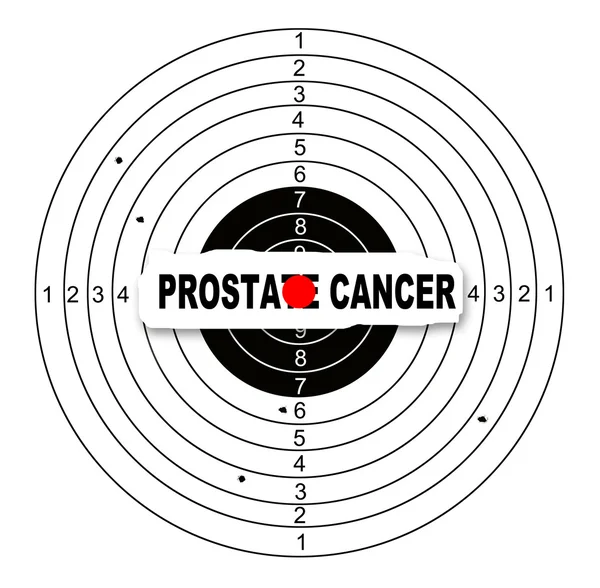 Prostat Kanseri — Stok fotoğraf