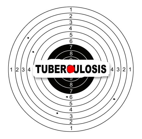 Tuberculose — Fotografia de Stock