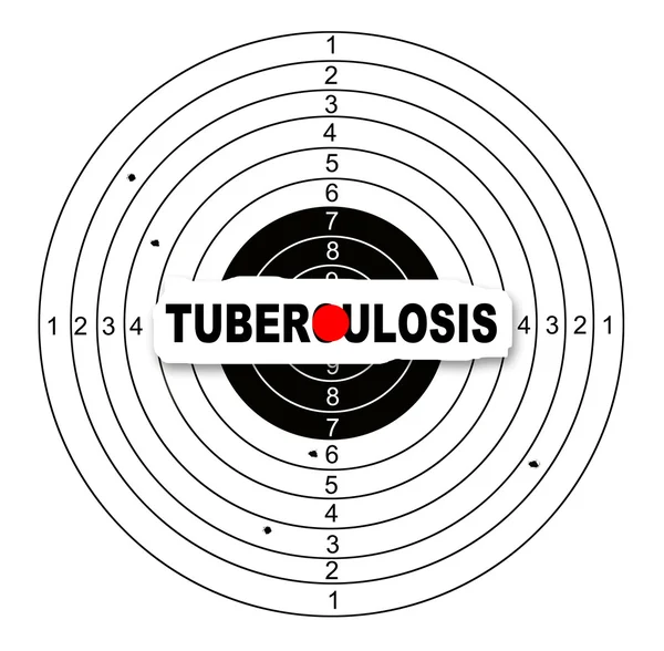 Tuberculosis — Foto de Stock