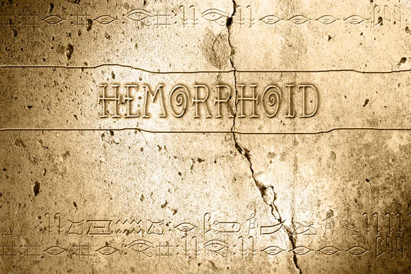 Hemorrhoid — Φωτογραφία Αρχείου