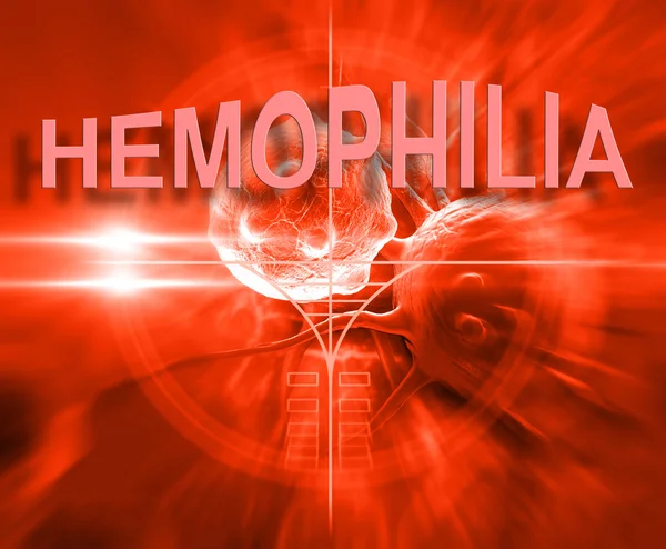 Hemophilia — Stock Photo, Image