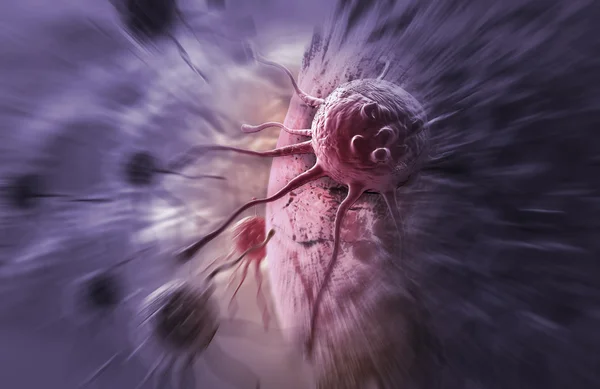 Kanser Hücresi — Stok fotoğraf