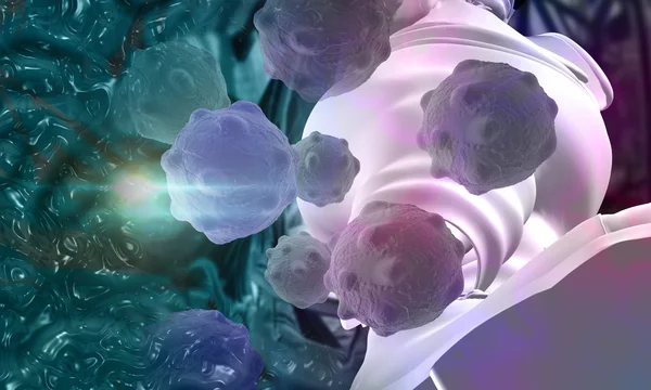 Cancer cell — Stock Photo, Image