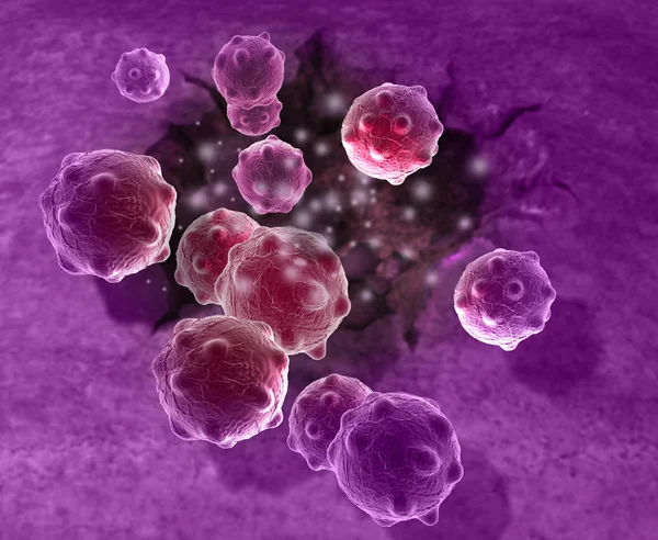 癌症细胞 — 图库照片