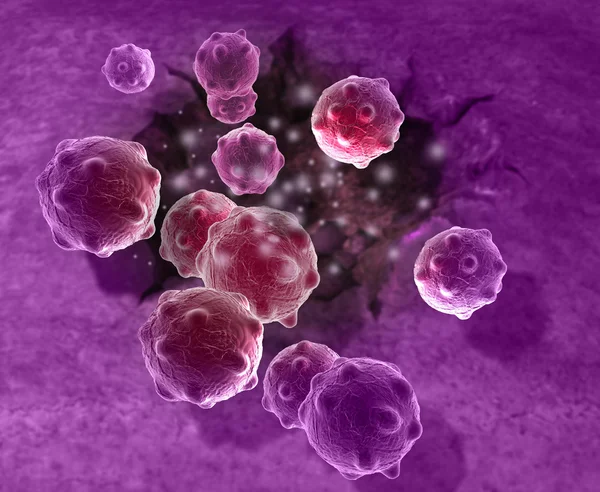 Cancer cell — Stock Photo, Image