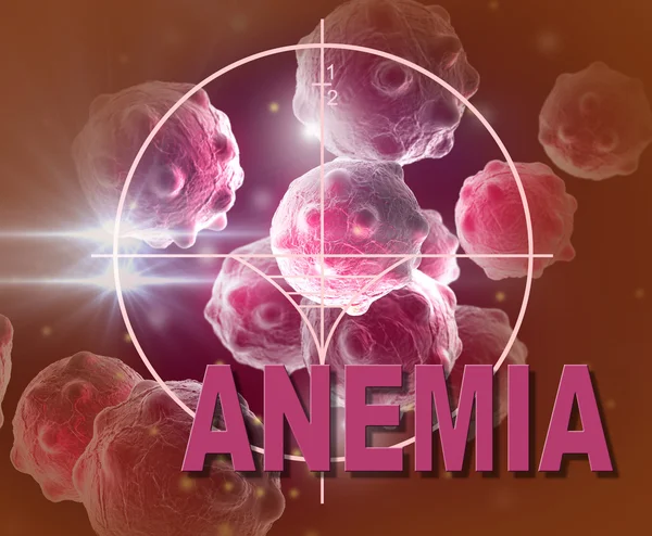 Anemia — Foto Stock