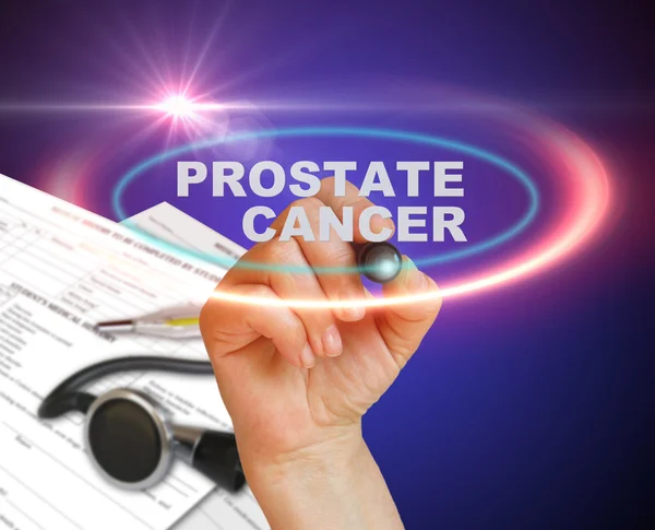 Cancro da próstata — Fotografia de Stock