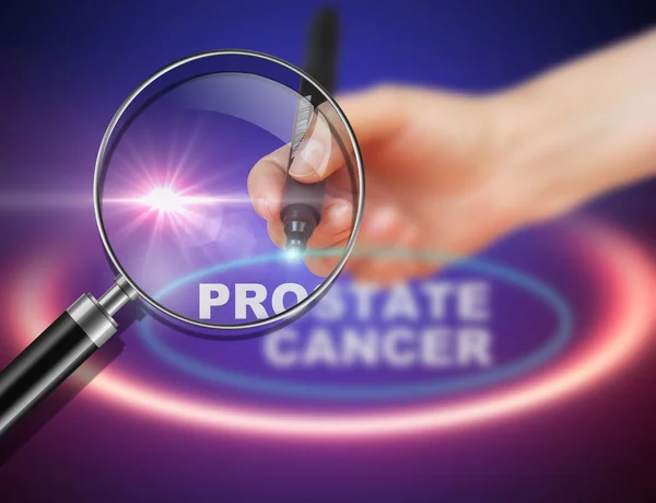 Escrita palavra PROSTATE CANCER com marcador em fundo gradiente feito em software 2d — Fotografia de Stock