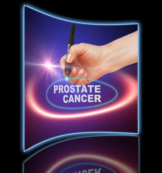 Schreiben von Wort Prostatakrebs mit Marker auf Gradientenhintergrund made in 2d software — Stockfoto
