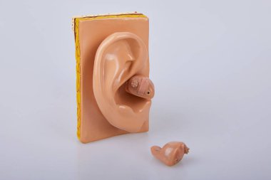 İşitme cihazı. İşitme cihazı işitme uzmanı seçimi