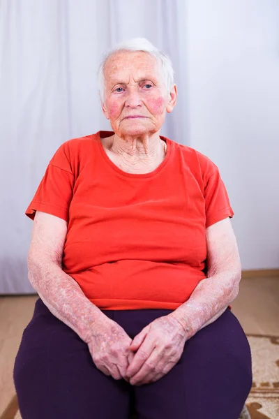 Mujer mayor triste y enferma — Foto de Stock