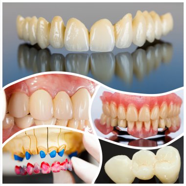 Modern dental ürünler