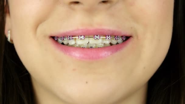 Nahaufnahme eines lächelnden jungen Mädchens mit Zahnspange