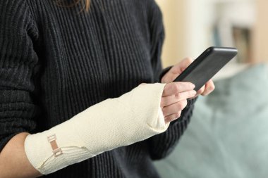 Yaralı bir kadının eli bandajlı ve evde cep telefonu kullanan ellerini kapatın.