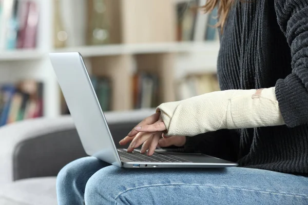 Close Uma Mulher Com Deficiência Com Braço Enfaixado Usando Laptop — Fotografia de Stock