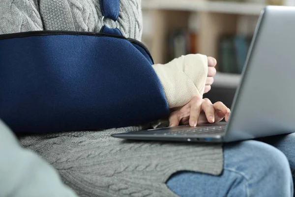 Close Uma Mulher Com Braço Quebrado Usando Funda Usando Laptop — Fotografia de Stock