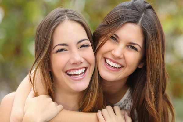 Dos amigas riendo con un diente blanco perfecto Imágenes de stock libres de derechos