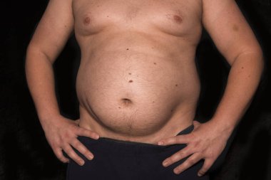 Karın şişmanlığı ve geniş bir göbeği olan bir adamın çıplak gövdesi. Sağlıksız yaşam tarzı ve kilo verme kavramı. Sağlık sorunları, kilo sorunları, obezite, aşırı yeme, depresyon, güvensizlik