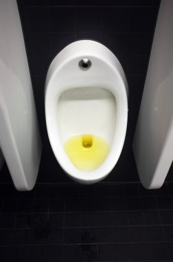 Engellenen umumi tuvalet pisuara