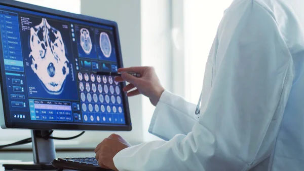 在医院办公室工作的专业医生使用计算机技术 神经外科和保健概念 — 图库照片