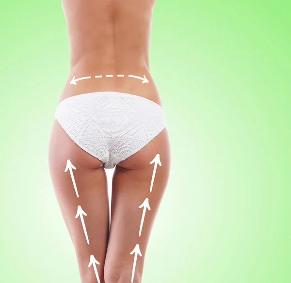 Belles jambes avec des flèches sur les hanches. Concept de chirurgie plastique — Photo