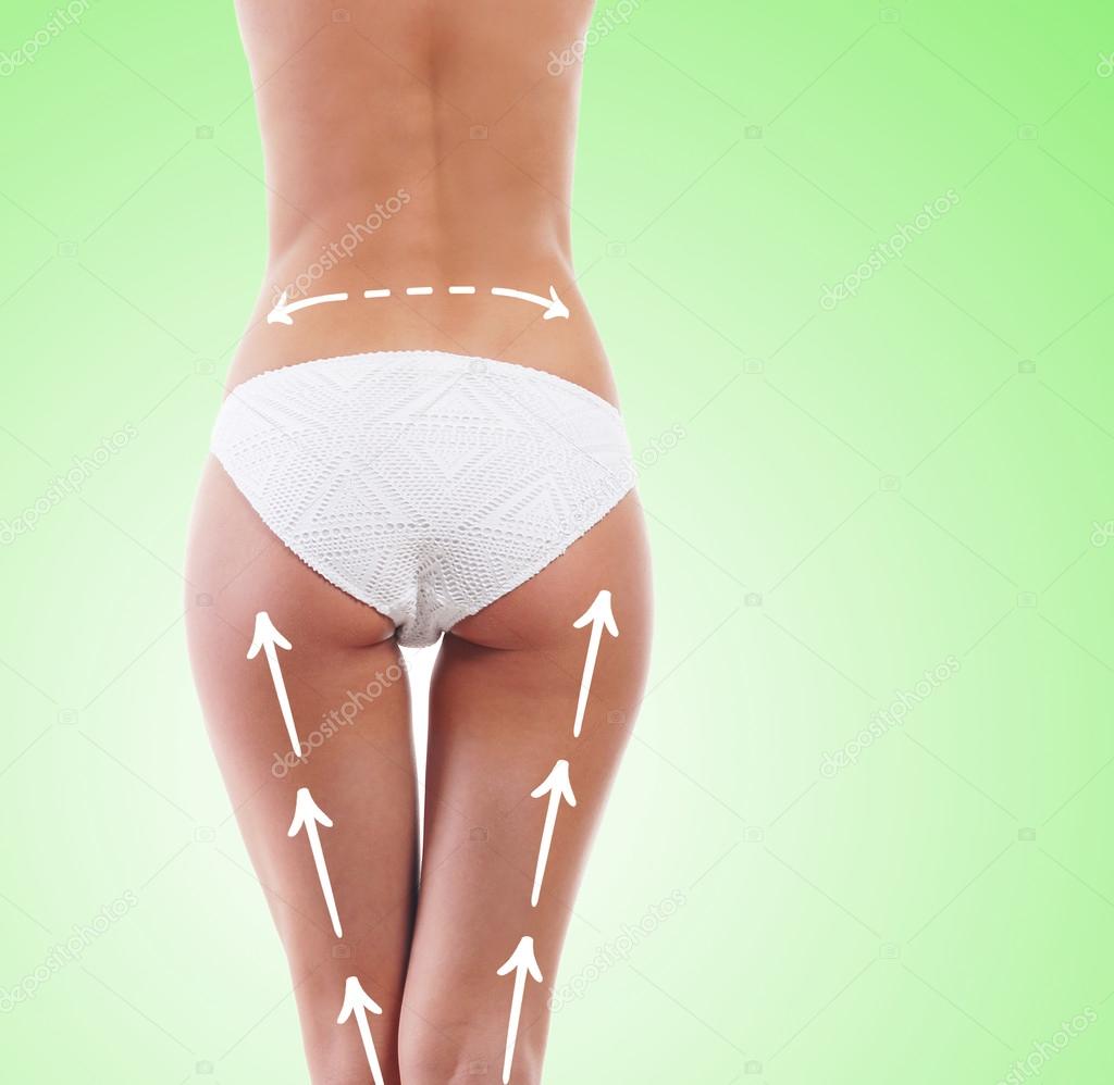 Beautiful legs with arrows on hips. Plastic surgery concept