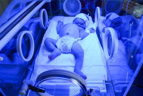 Новорожденный получает лечение желтухи под ультрафиолетовым светом — стоковое фото