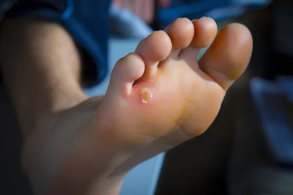 Ayak üzerinde Nasır