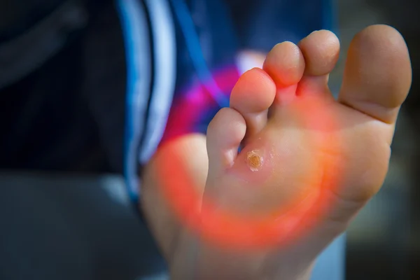 Ayak üzerinde Nasır