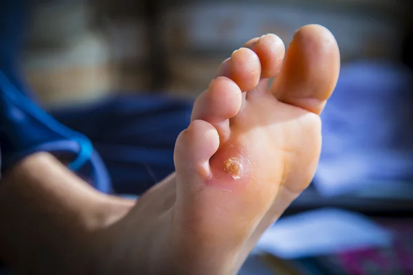 Ayak üzerinde Nasır