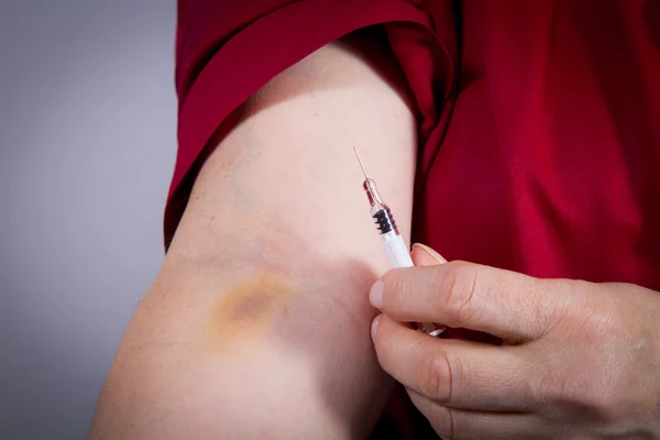 Auto-injeção de terapia intravenosa — Fotografia de Stock