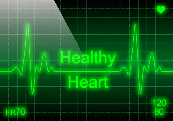 Zdrowe serce na zielony tętna — Zdjęcie stockowe