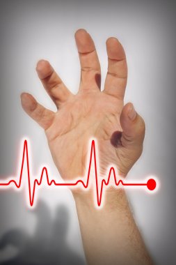 Hand expressing heart attack - Medical concept clipart