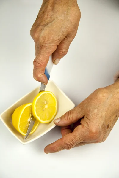 Rheumatoid arthritis hands — Stock Photo, Image