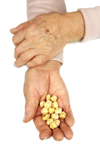 Rheumatoid arthritis hands — Stock Photo, Image
