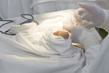 Doktorlar ameliyat yapma ellerde araçları