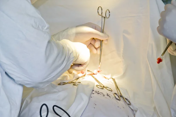 Médicos com ferramentas nas mãos fazendo cirurgia — Fotografia de Stock