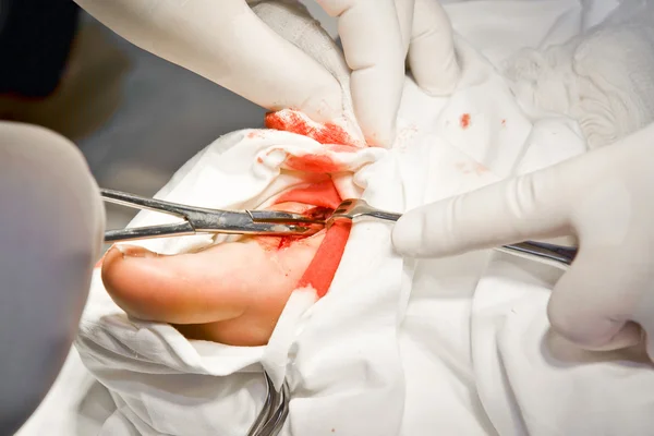 Médicos com ferramentas nas mãos fazendo cirurgia — Fotografia de Stock