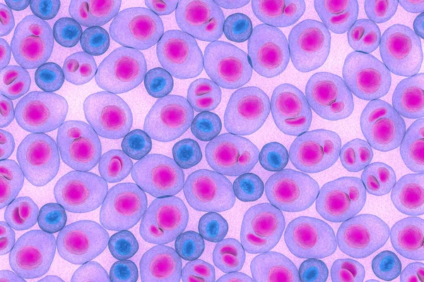 Myeloma multiplex lösemi kanseri 3d renk çizimi