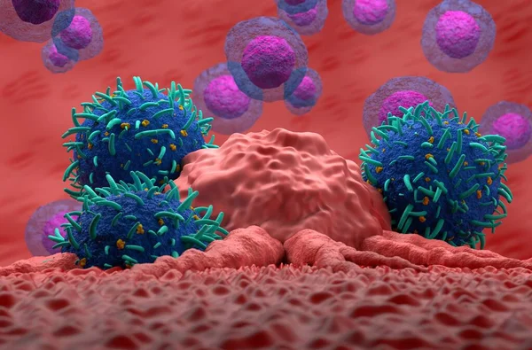 Hücreleri Kanser Tümörüne Saldırıyor — Stok fotoğraf