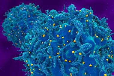 HIV virüsü saldırısı ve enfekte olmuş T-hücresi yakın plan 3D çizim