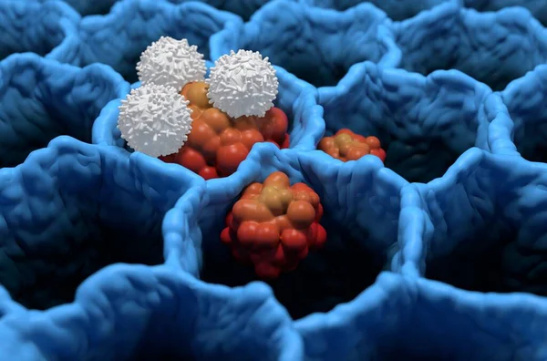 Les Lymphocytes Attaquent Les Petites Cellules Cancer Poumon Microbiologie Des — Photo