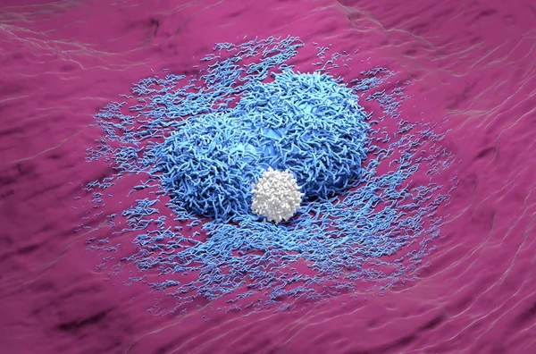 Liver cancer hepatoma blue color with t-cell realistic isometric view 3d illustration
