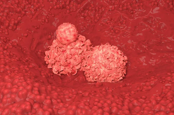Göğüs Kanseri Hücreleri Boyutlu Illüstrasyon Geliştiriyor — Stok fotoğraf