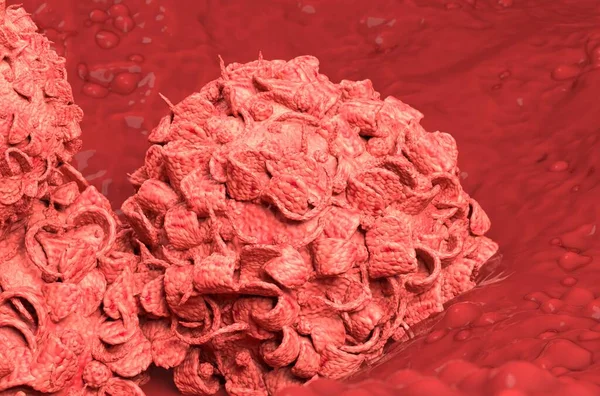 Göğüs Kanseri Hücreleri Yakınlaşarak Büyüyor Illüstrasyon — Stok fotoğraf