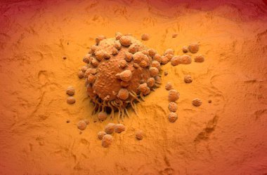Melanoma hücresi bir tür cilt kanseri izometrik görünüm 3D illüstrasyon