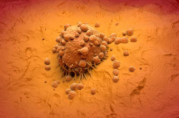 Melanoma Células Tipo Cáncer Piel Vista Isométrica Ilustración — Foto de Stock